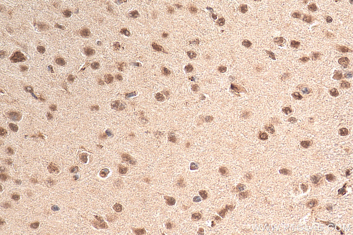 Immunohistochemistry (IHC) staining of mouse brain tissue using TCF4 Polyclonal antibody (22337-1-AP)