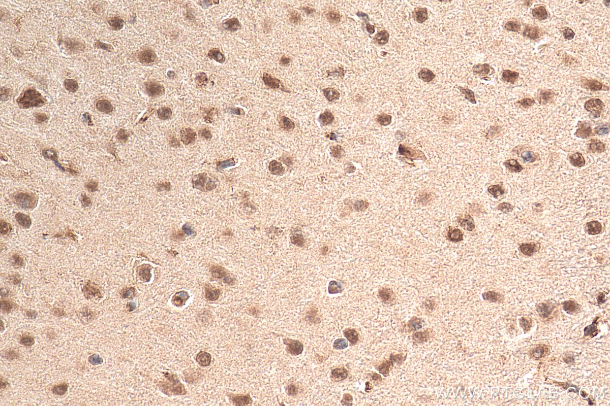 IHC staining of mouse brain using 22337-1-AP