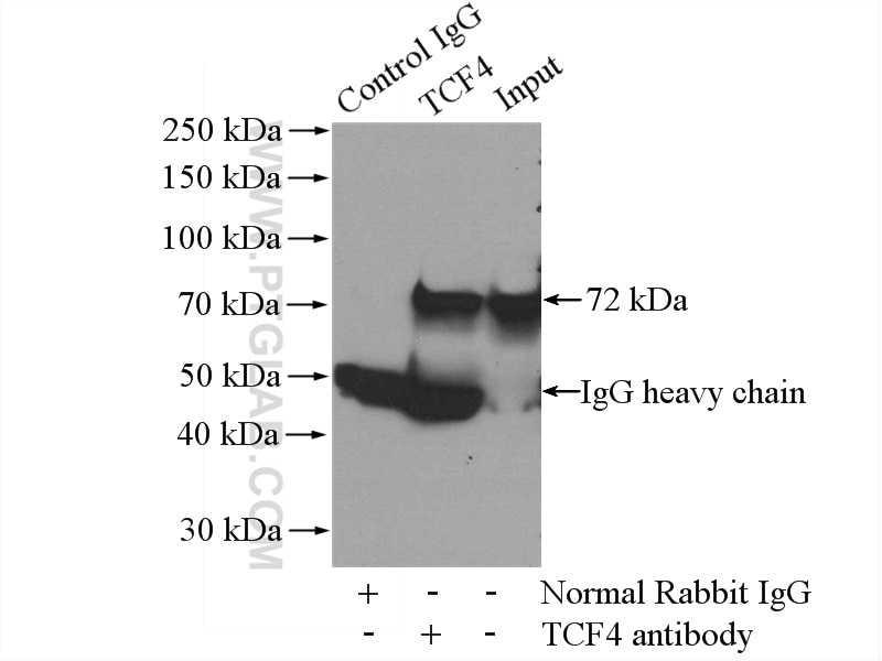 IP experiment of mouse lung using 22337-1-AP