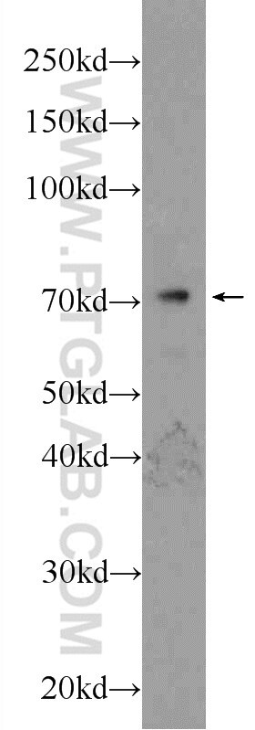 TCF4 Polyclonal antibody