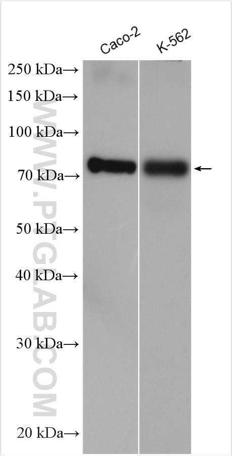 Western Blot (WB) analysis of various lysates using TCF4 Polyclonal antibody (22337-1-AP)