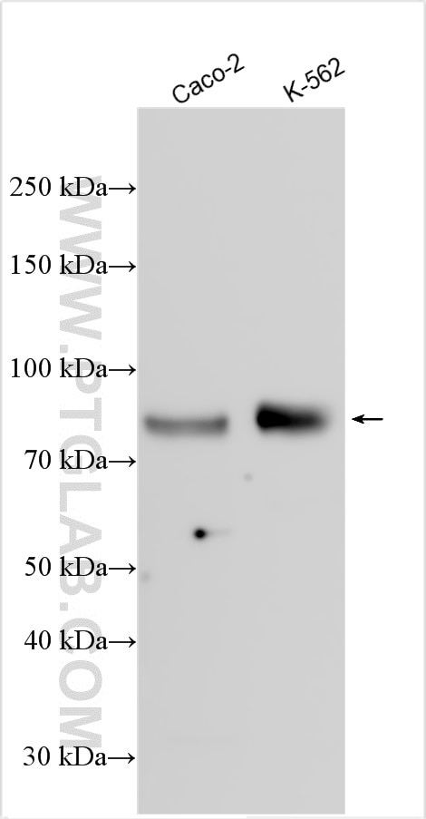 Western Blot (WB) analysis of various lysates using TCF4 Polyclonal antibody (22337-1-AP)