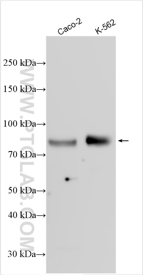 WB analysis using 22337-1-AP