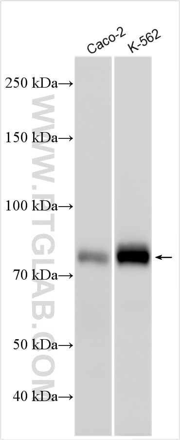 Western Blot (WB) analysis of various lysates using TCF4 Polyclonal antibody (22337-1-AP)
