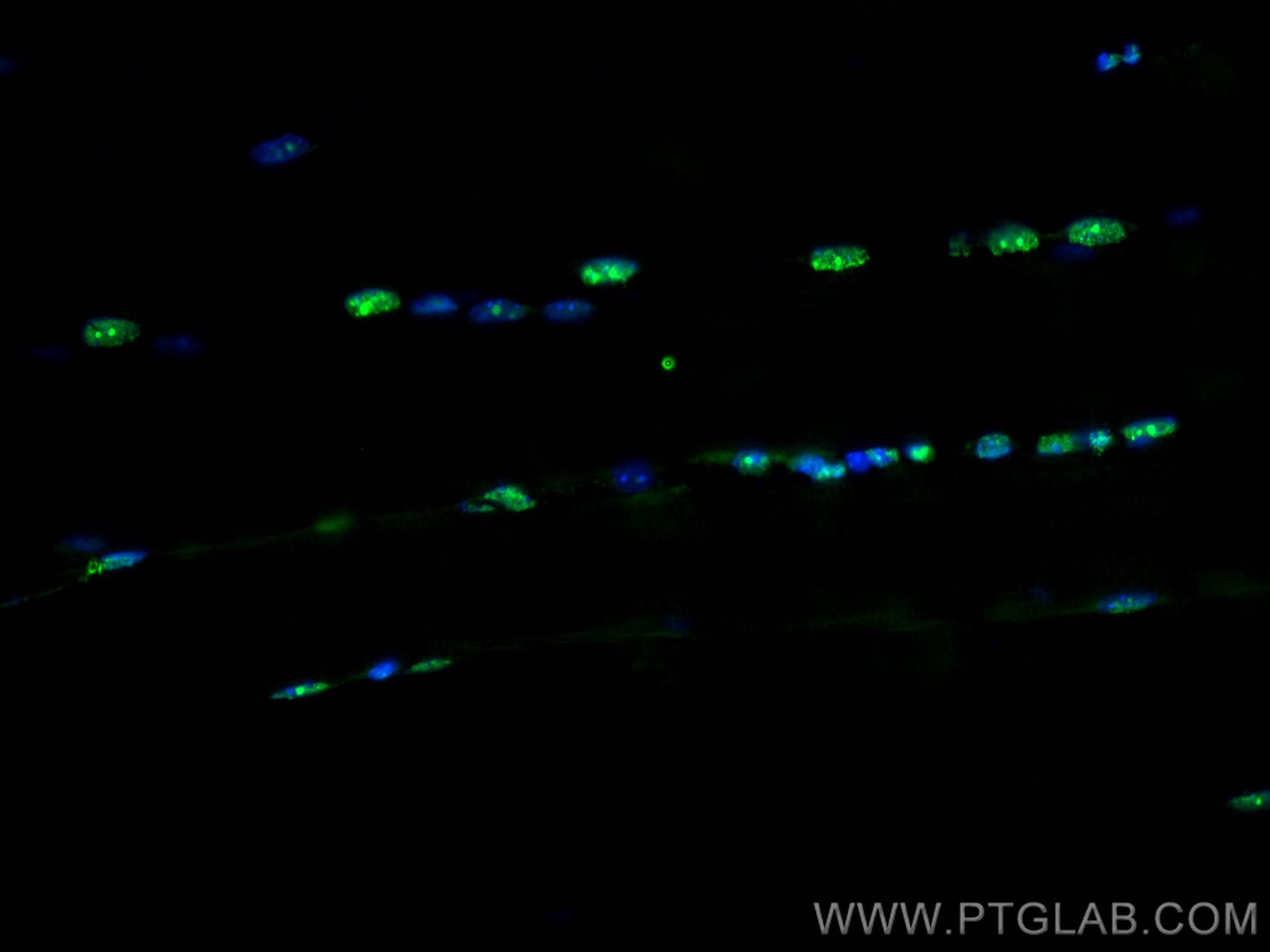 IF Staining of mouse skeletal muscle using CL488-22337