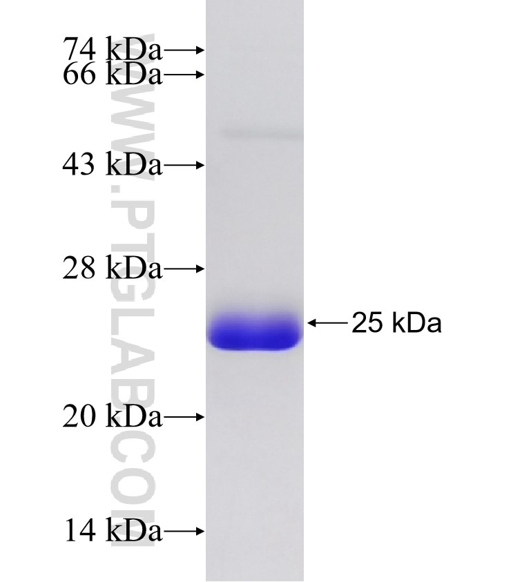 TCF4 fusion protein Ag17897 SDS-PAGE