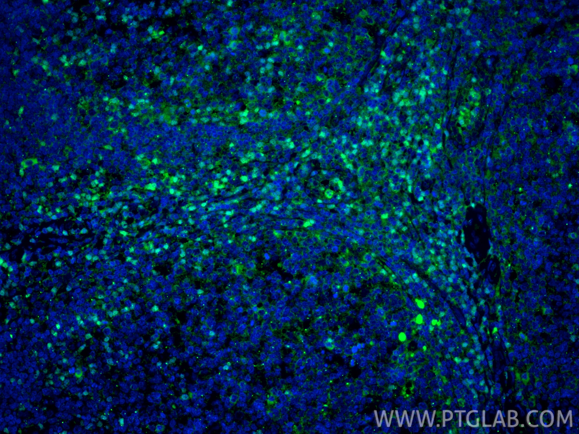 Immunofluorescent analysis of (4% PFA) fixed paraffin-embedded human tonsillitis tissue using TCF1/TCF7 antibody (14464-1-AP) at dilution of 1:200 and CoraLite®488-Conjugated Goat Anti-Rabbit IgG(H+L) (SA00013-2). Heat mediated antigen retrieval with Tris-EDTA buffer (pH 9.0). Immunofluorescence (IF) / fluorescent staining of human tonsillitis tissue using TCF1/TCF7 Polyclonal antibody (14464-1-AP)