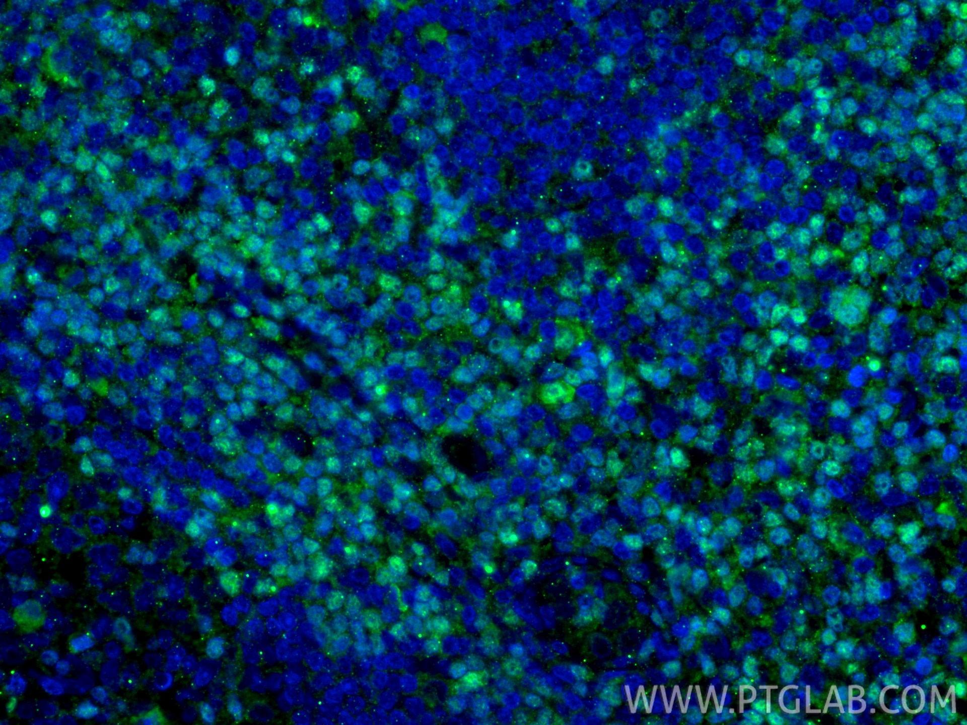 Immunofluorescent analysis of (4% PFA) fixed paraffin-embedded human tonsillitis tissue using TCF1/TCF7 antibody (14464-1-AP) at dilution of 1:200 and CoraLite®488-Conjugated Goat Anti-Rabbit IgG(H+L) (SA00013-2). Heat mediated antigen retrieval with Tris-EDTA buffer (pH 9.0). Immunofluorescence (IF) / fluorescent staining of human tonsillitis tissue using TCF1/TCF7 Polyclonal antibody (14464-1-AP)