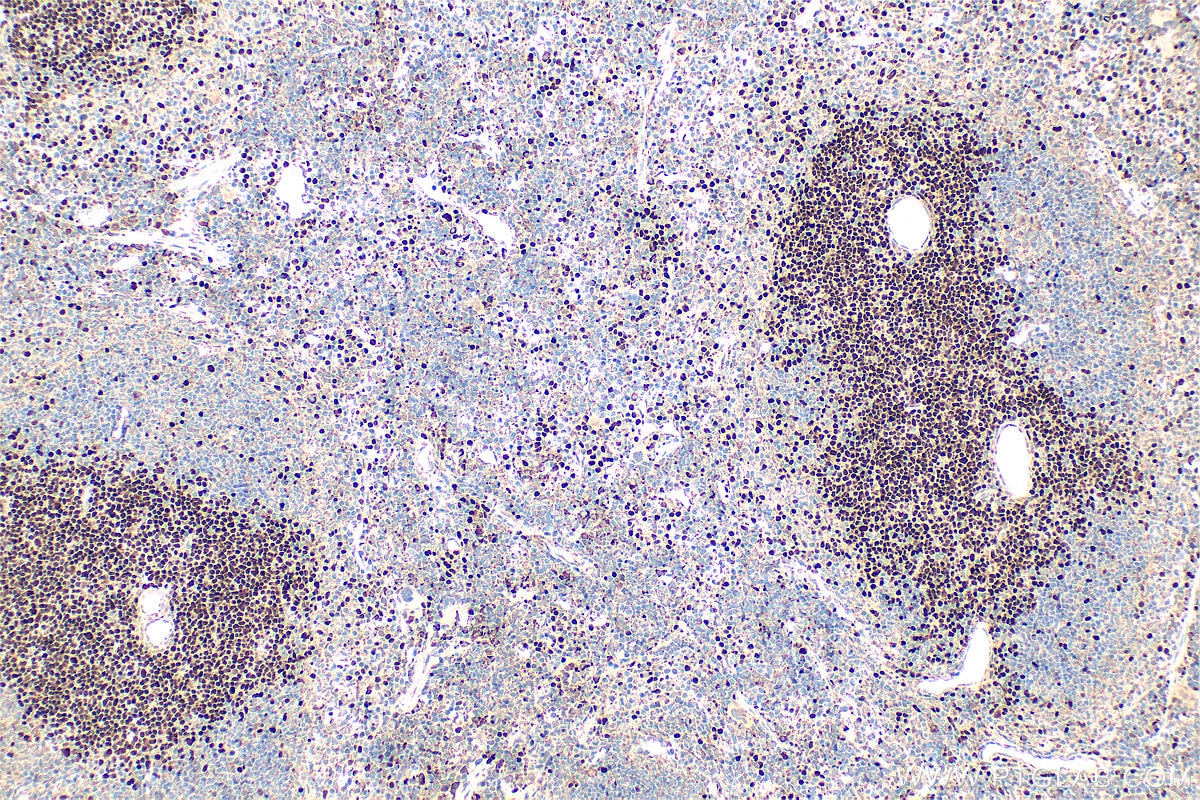 Immunohistochemical analysis of paraffin-embedded mouse spleen tissue slide using 14464-1-AP (TCF1/TCF7 antibody) at dilution of 1:200 (under 10x lens). Heat mediated antigen retrieval with Tris-EDTA buffer (pH 9.0). Immunohistochemistry (IHC) staining of mouse spleen tissue using TCF1/TCF7 Polyclonal antibody (14464-1-AP)