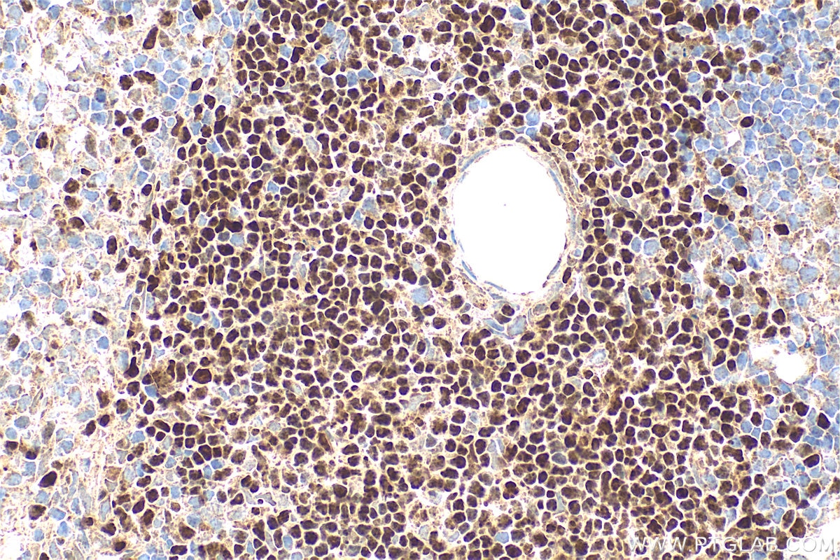 Immunohistochemical analysis of paraffin-embedded mouse spleen tissue slide using 14464-1-AP (TCF1/TCF7 antibody) at dilution of 1:200 (under 40x lens). Heat mediated antigen retrieval with Tris-EDTA buffer (pH 9.0). Immunohistochemistry (IHC) staining of mouse spleen tissue using TCF1/TCF7 Polyclonal antibody (14464-1-AP)