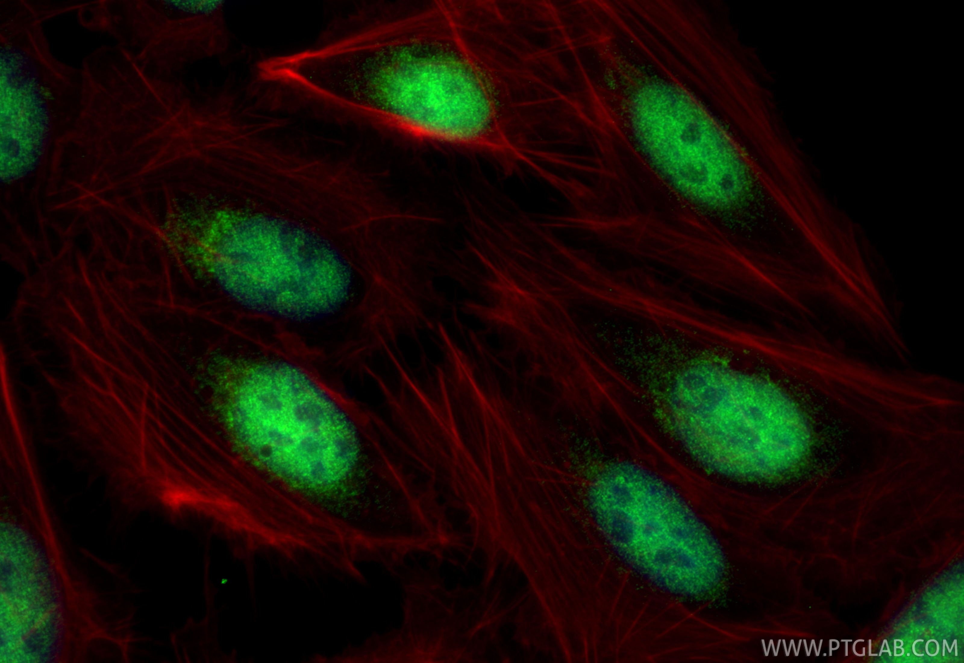 IF Staining of U2OS using 14519-1-AP Immunofluorescence (IF) / fluorescent staining of U2OS cells using TCF7L1 Polyclonal antibody (14519-1-AP)
