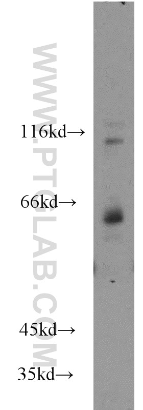 Western Blot (WB) analysis of mouse brain tissue using TCF7L1 Polyclonal antibody (14519-1-AP)