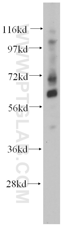 Western Blot (WB) analysis of mouse brain tissue using TCF7L1 Polyclonal antibody (14519-1-AP)