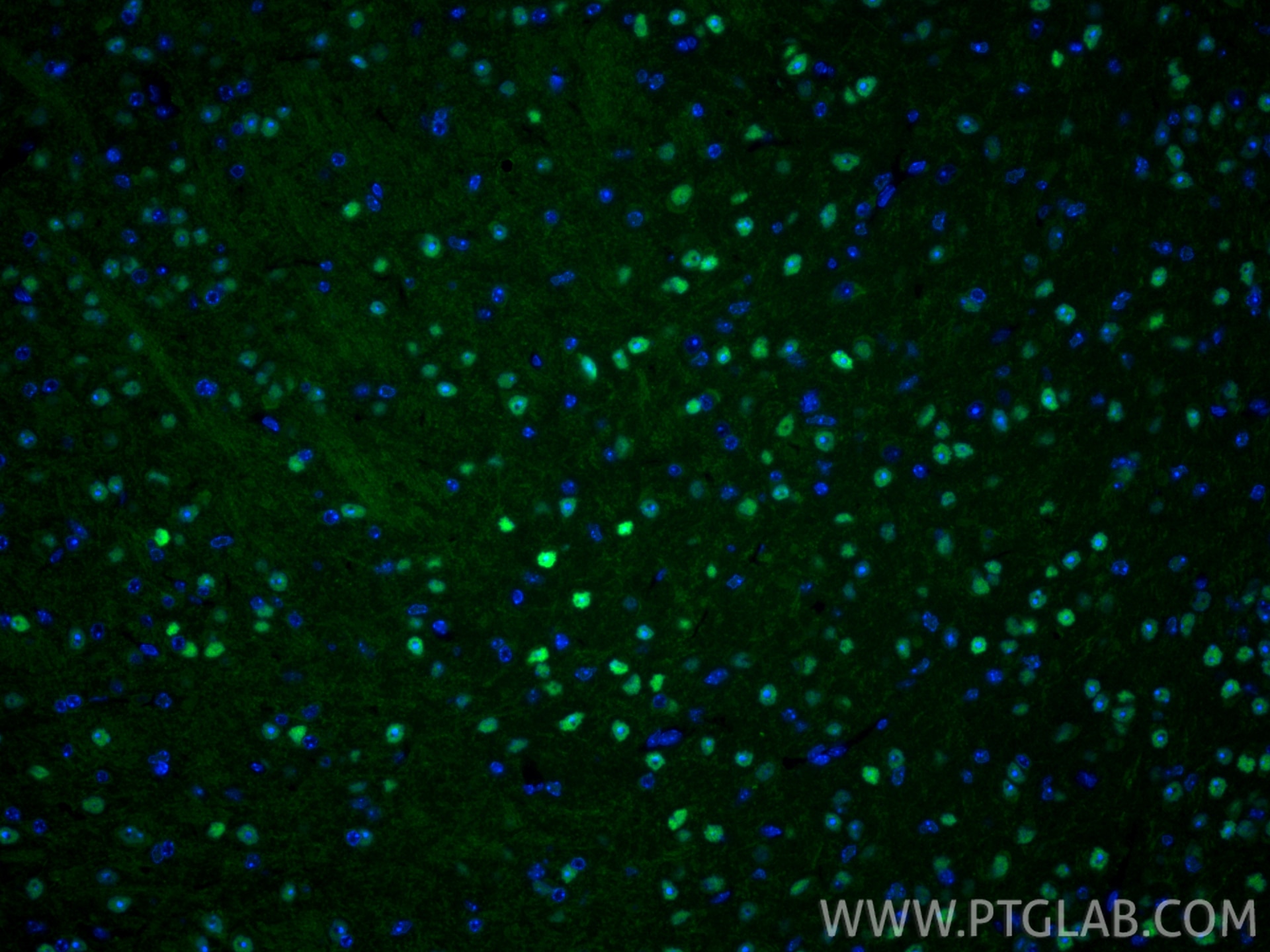 IF Staining of mouse brain using 83588-3-RR Immunofluorescence (IF) / fluorescent staining of mouse brain tissue using TCF7L1 Recombinant monoclonal antibody (83588-3-RR)