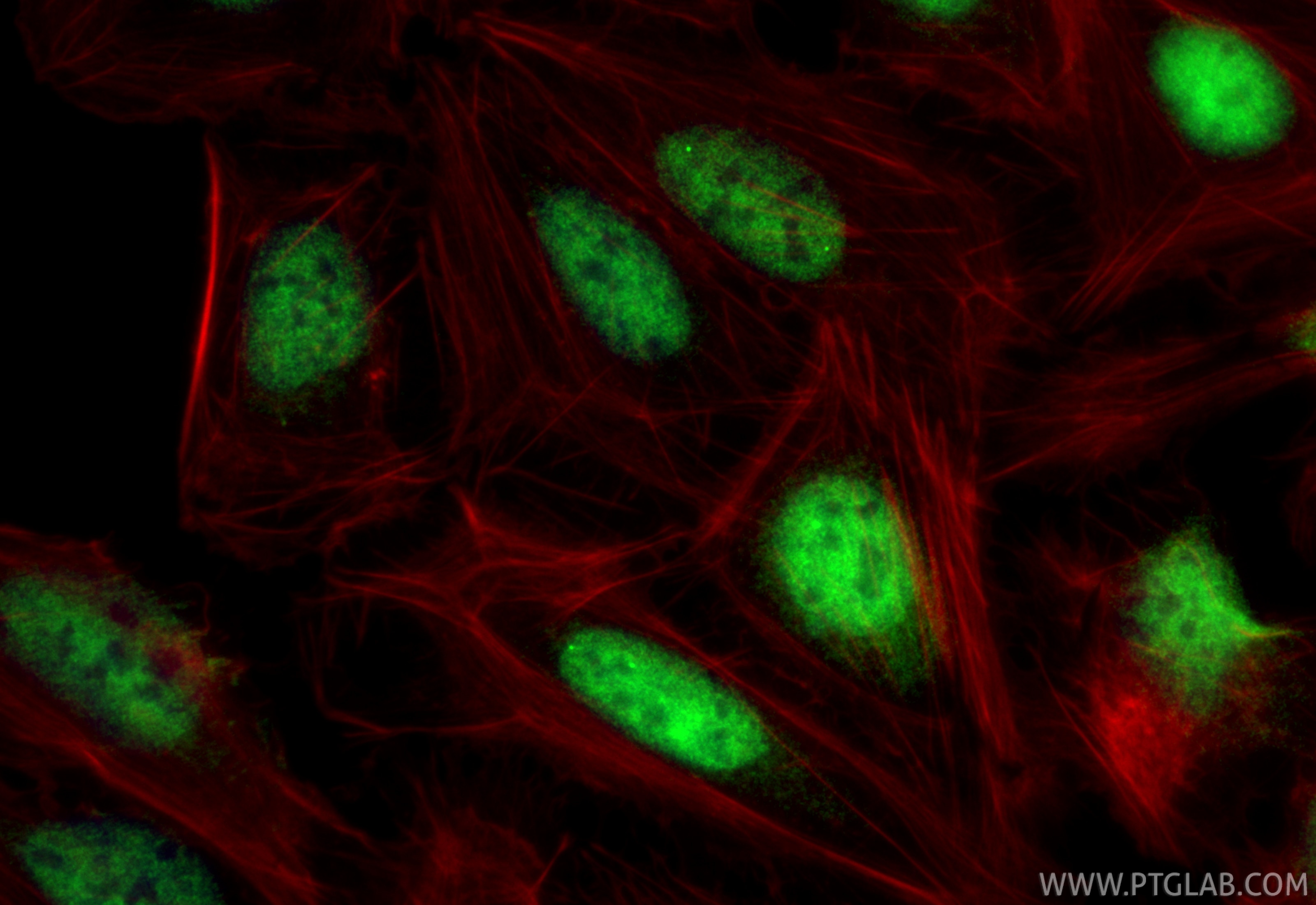 IF Staining of U2OS using 83588-3-RR Immunofluorescence (IF) / fluorescent staining of U2OS cells using TCF7L1 Recombinant monoclonal antibody (83588-3-RR)