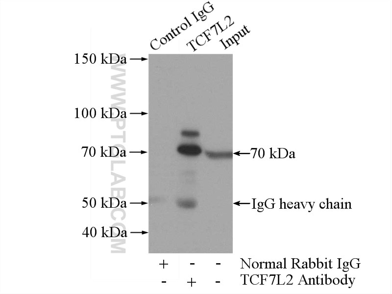 Immunoprecipitation (IP) experiment of mouse liver tissue using TCF4/TCF7L2 Polyclonal antibody (13838-1-AP)