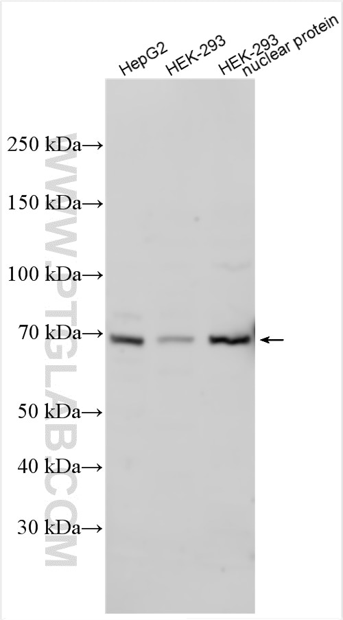 Western Blot (WB) analysis of various lysates using TCF4/TCF7L2 Polyclonal antibody (13838-1-AP)