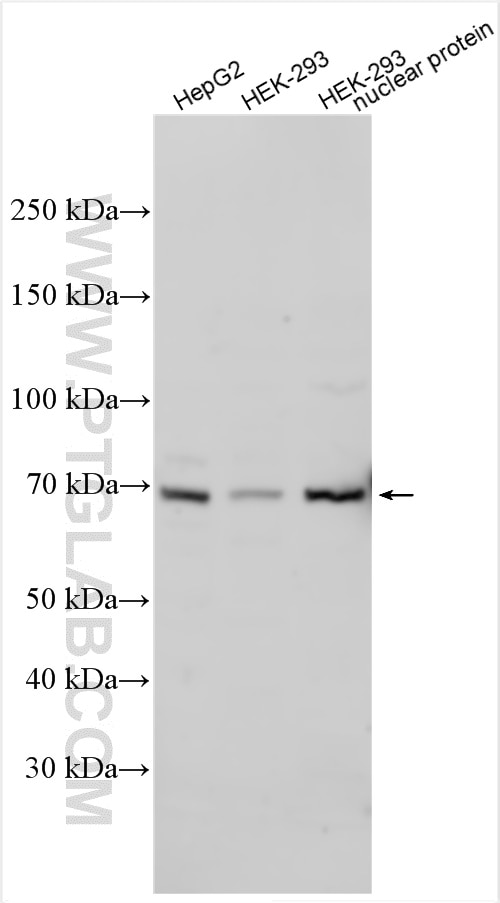 WB analysis using 13838-1-AP