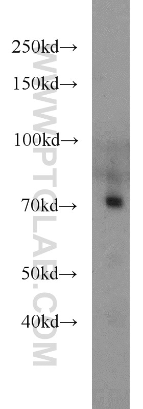 Western Blot (WB) analysis of mouse kidney tissue using TCF4/TCF7L2 Polyclonal antibody (13838-1-AP)