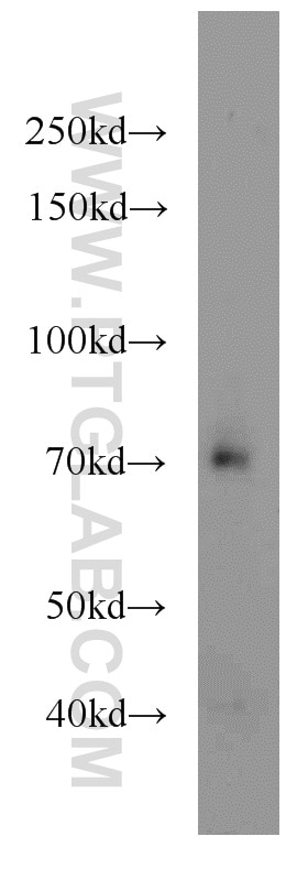 Western Blot (WB) analysis of mouse liver tissue using TCF4/TCF7L2 Polyclonal antibody (13838-1-AP)