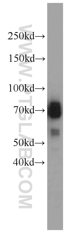 Western Blot (WB) analysis of mouse heart tissue using TCF4/TCF7L2 Polyclonal antibody (13838-1-AP)