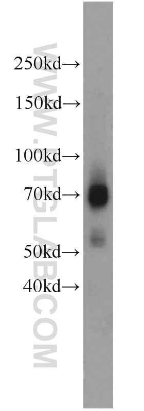Western Blot (WB) analysis of mouse placenta tissue using TCF4/TCF7L2 Polyclonal antibody (13838-1-AP)