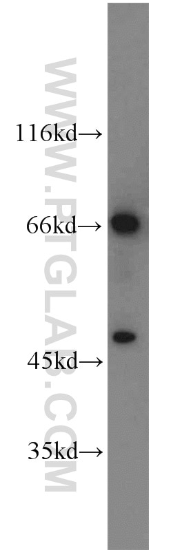 Western Blot (WB) analysis of rat liver tissue using TCF4/TCF7L2 Polyclonal antibody (13838-1-AP)