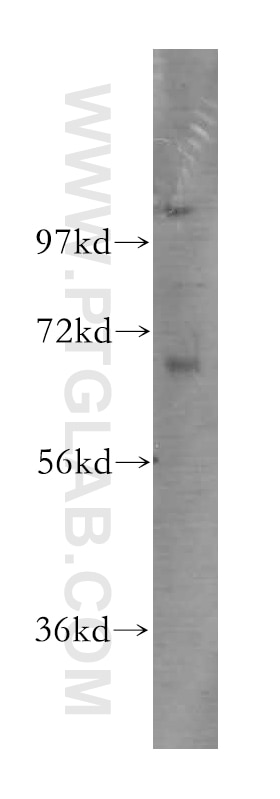 Western Blot (WB) analysis of human brain tissue using TCF4/TCF7L2 Polyclonal antibody (13838-1-AP)