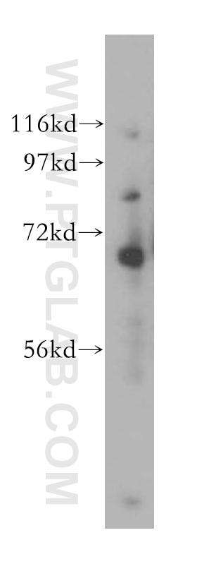 Western Blot (WB) analysis of human heart tissue using TCF4/TCF7L2 Polyclonal antibody (13838-1-AP)