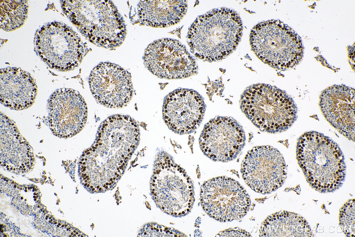 IHC staining of mouse testis using 29404-1-AP