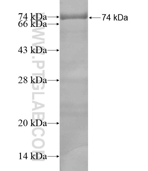 TCHHL1 fusion protein Ag20070 SDS-PAGE
