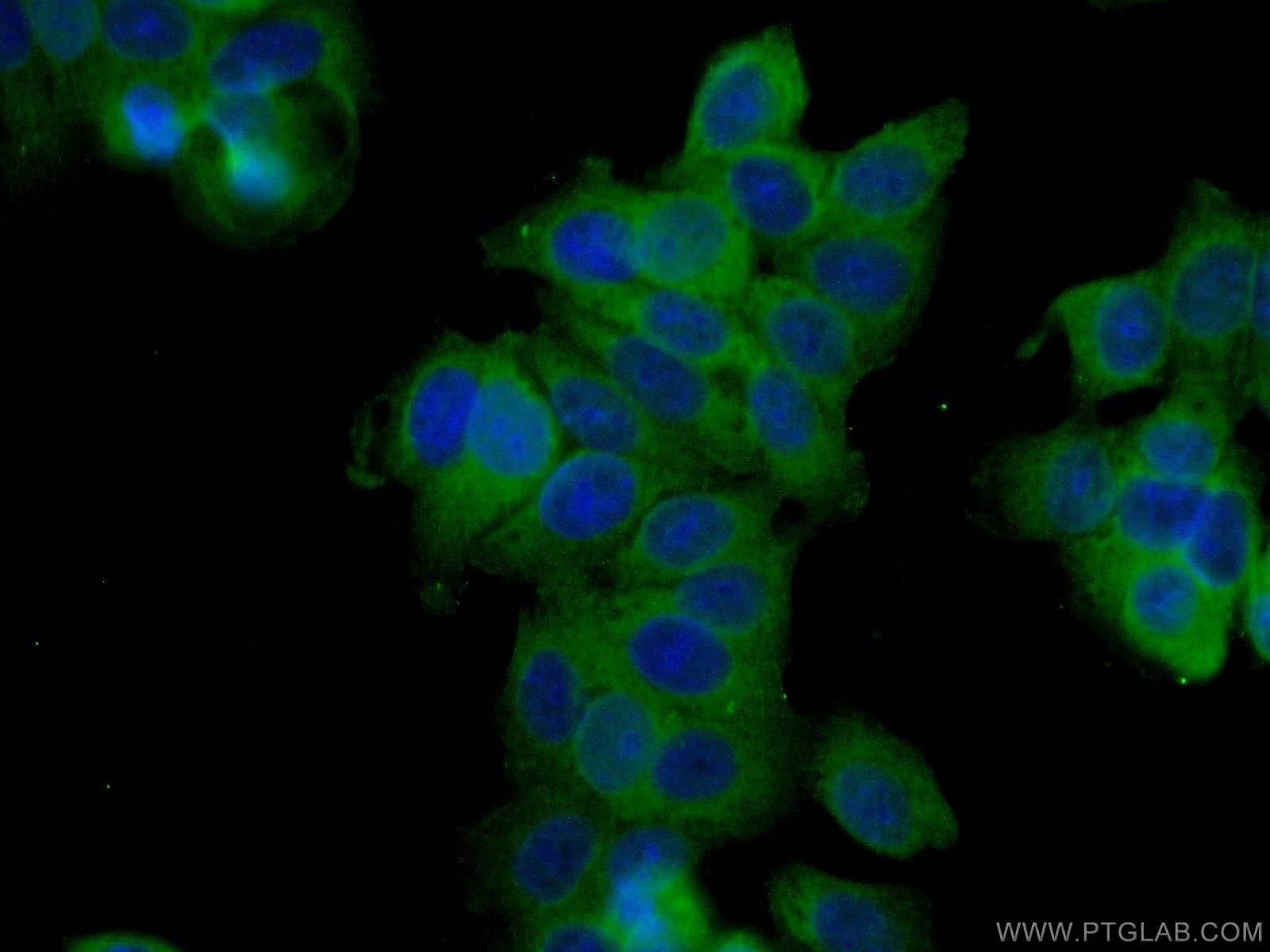 Immunofluorescence (IF) / fluorescent staining of MCF-7 cells using TCHP Polyclonal antibody (25931-1-AP)