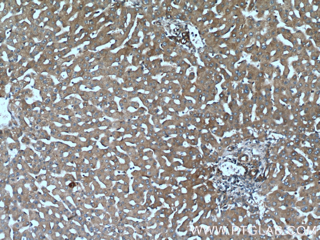 Immunohistochemistry (IHC) staining of human liver tissue using TCHP Polyclonal antibody (25931-1-AP)