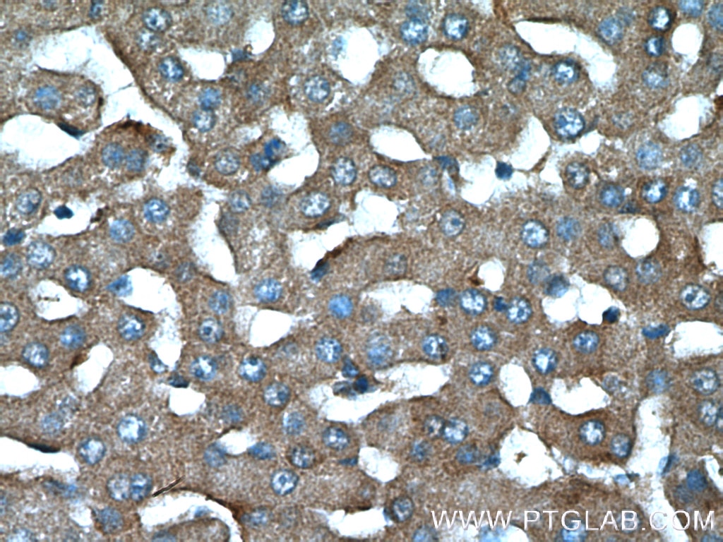 IHC staining of human liver using 25931-1-AP