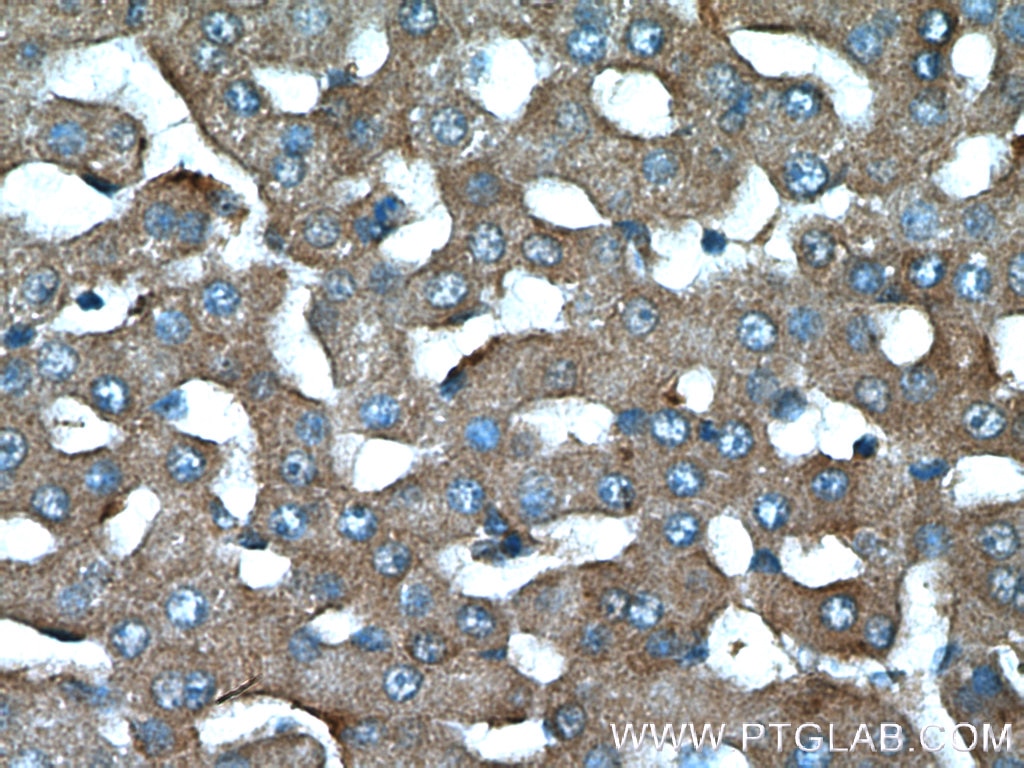 Immunohistochemistry (IHC) staining of human liver tissue using TCHP Polyclonal antibody (25931-1-AP)