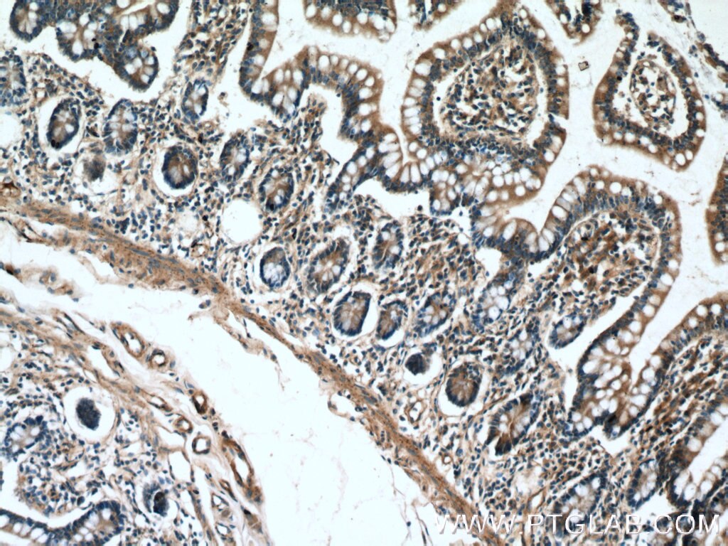 IHC staining of human small intestine using 25931-1-AP