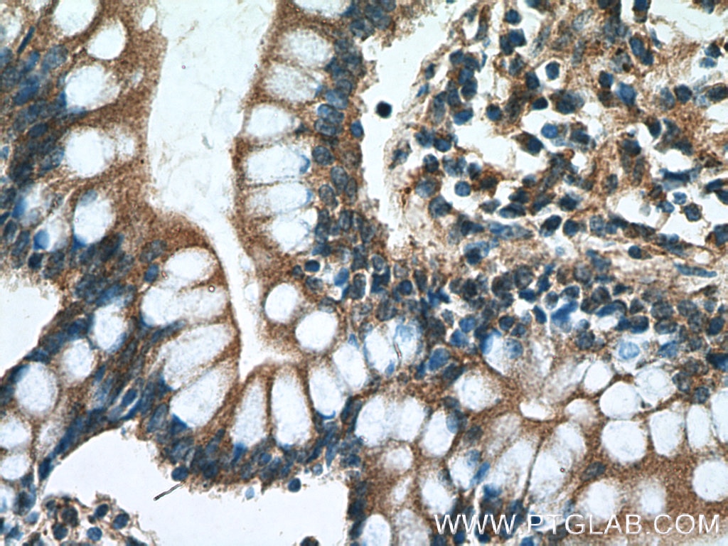 Immunohistochemistry (IHC) staining of human small intestine tissue using TCHP Polyclonal antibody (25931-1-AP)