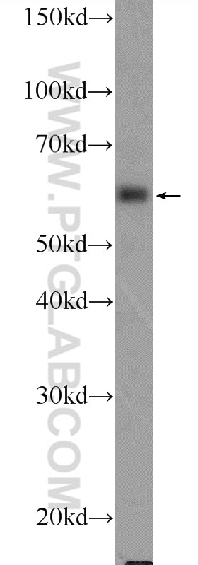 Western Blot (WB) analysis of MCF-7 cells using TCHP Polyclonal antibody (25931-1-AP)