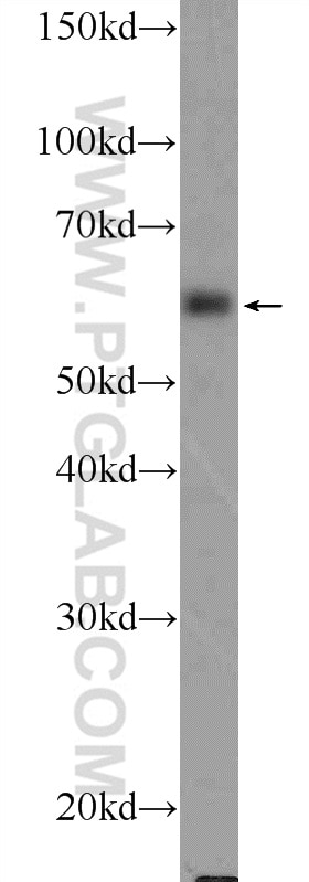 WB analysis of MCF-7 using 25931-1-AP