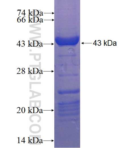 TCHP fusion protein Ag23199 SDS-PAGE