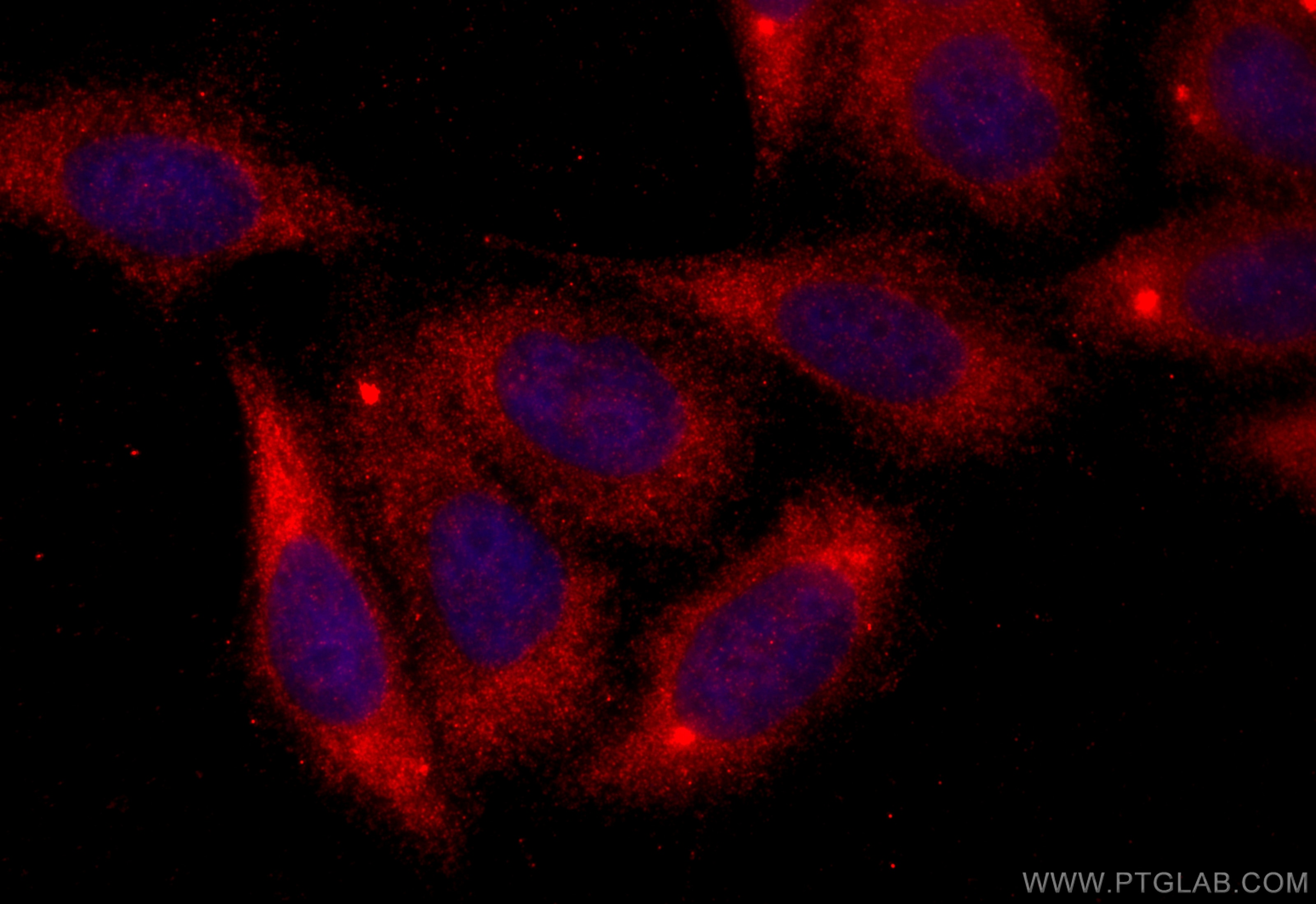 Immunofluorescence (IF) / fluorescent staining of HepG2 cells using TCIRG1 Polyclonal antibody (12649-1-AP)