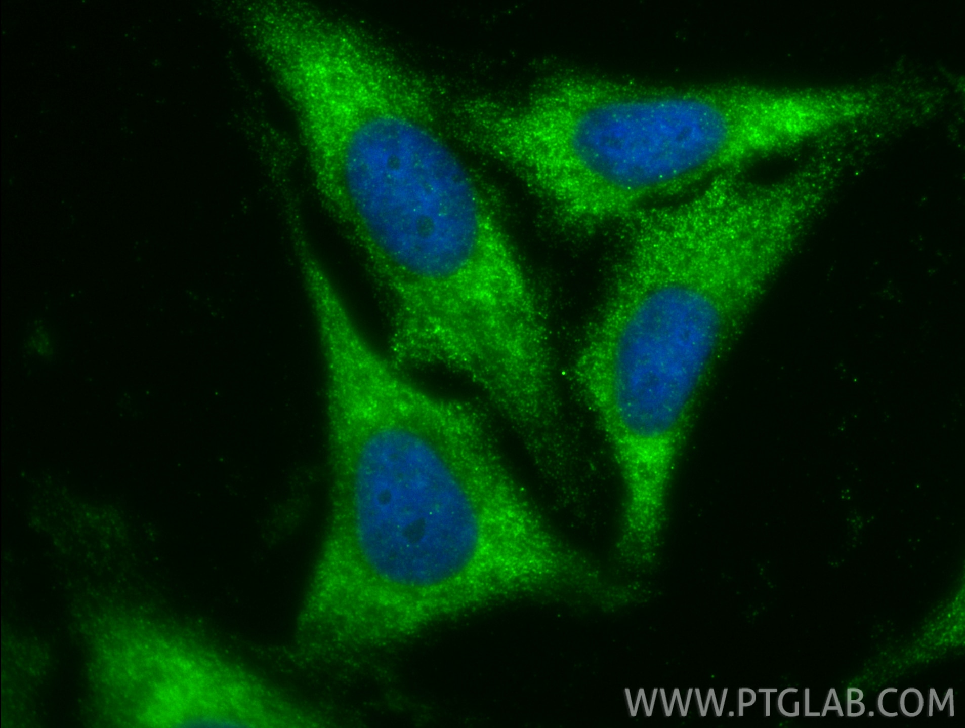 IF Staining of HepG2 using 12649-1-AP (same clone as 12649-1-PBS) Immunofluorescence (IF) / fluorescent staining of HepG2 cells using TCIRG1 Polyclonal antibody (12649-1-AP)