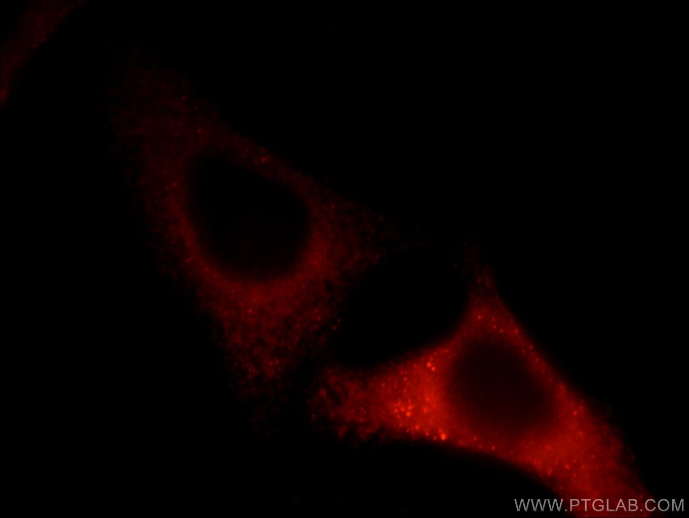 Immunofluorescence (IF) / fluorescent staining of HepG2 cells using TCIRG1 Polyclonal antibody (12649-1-AP)