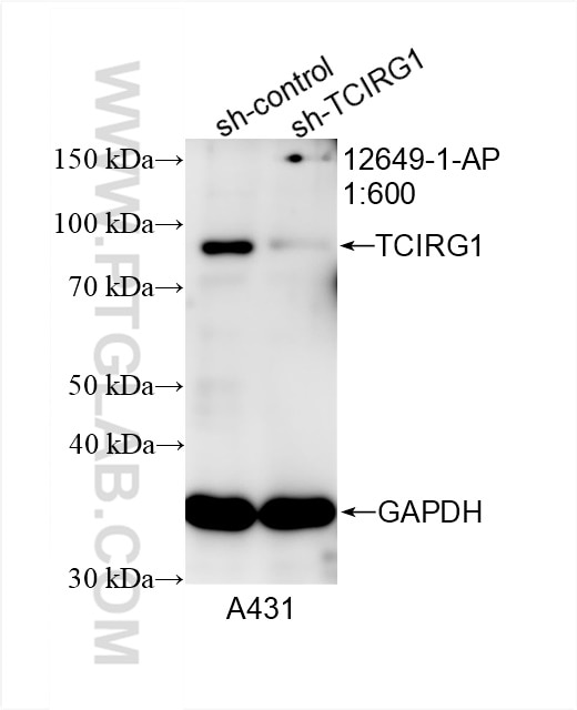 Western Blot (WB) analysis of A431 cells using TCIRG1 Polyclonal antibody (12649-1-AP)