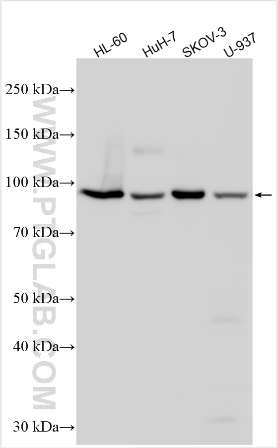 Western Blot (WB) analysis of various lysates using TCIRG1 Polyclonal antibody (12649-1-AP)
