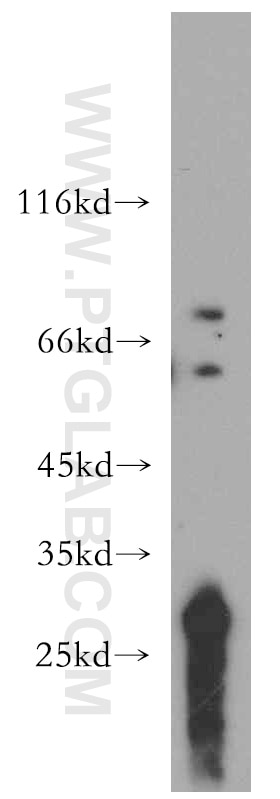 Western Blot (WB) analysis of HL-60 cells using TCIRG1 Polyclonal antibody (12649-1-AP)
