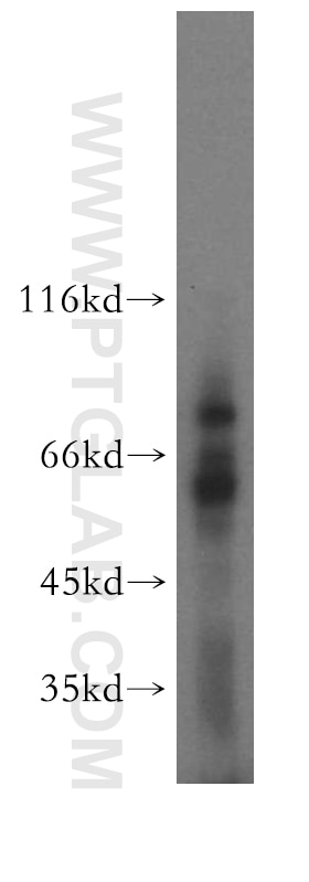 Western Blot (WB) analysis of U-937 cells using TCIRG1 Polyclonal antibody (12649-1-AP)