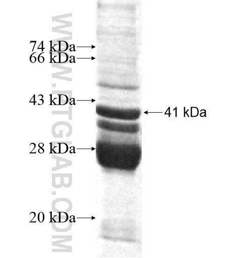 TCL1B fusion protein Ag10264 SDS-PAGE