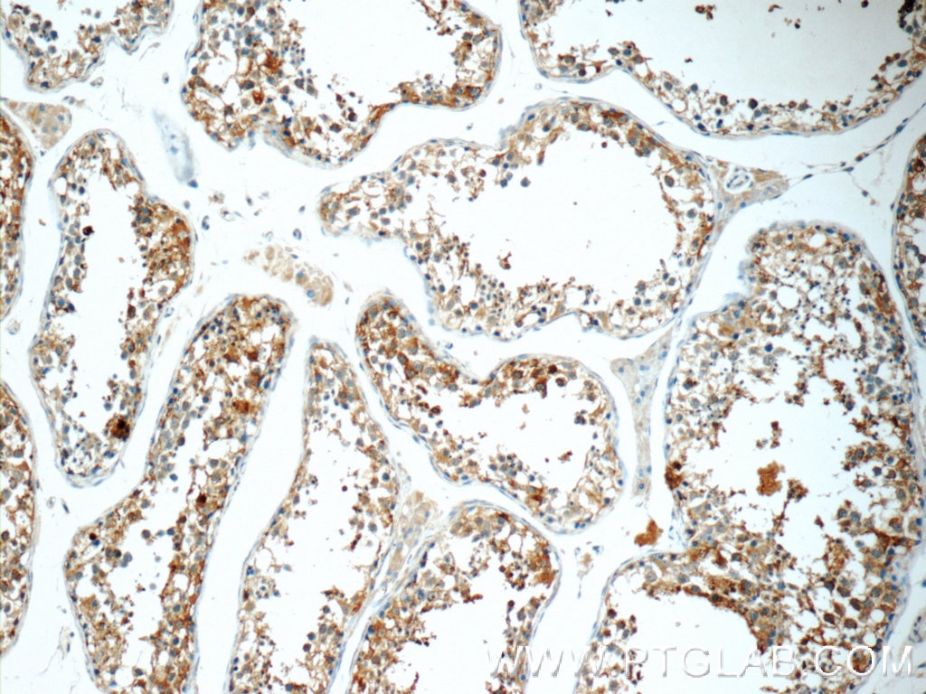 Immunohistochemistry (IHC) staining of human testis tissue using TCN1 Polyclonal antibody (16078-1-AP)