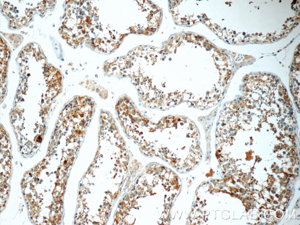 IHC staining of human testis using 16078-1-AP